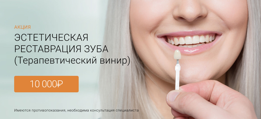Эстетическая реставрация зуба (терапевтический винир) Пушкин
